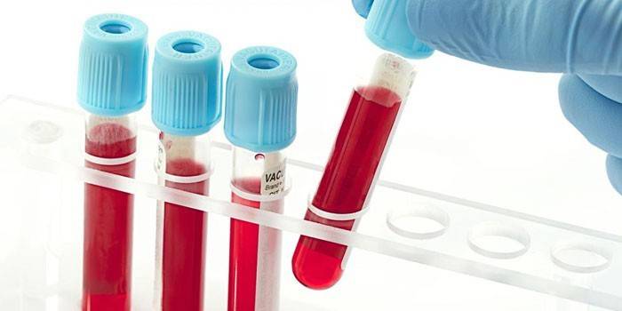 Krvné testy in vitro