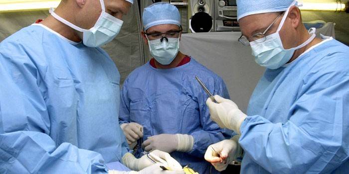 Doctores en la operación