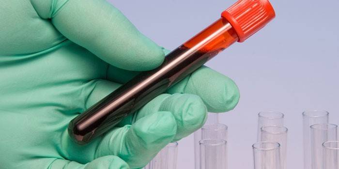 Análisis de sangre in vitro