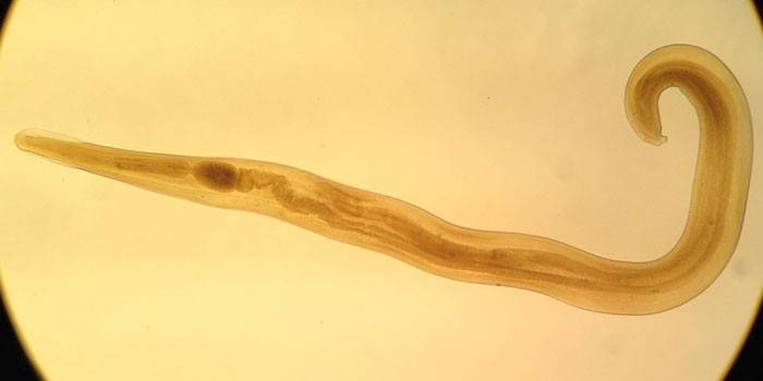 Parasita pinworm