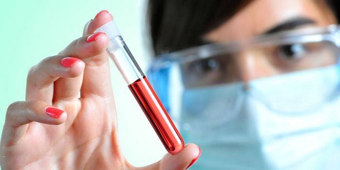 Menina, segura, um, tubo teste, com, sangue, em, dela, mão