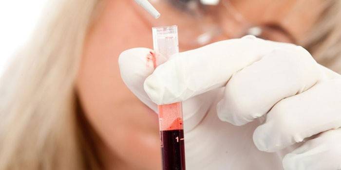 Laboratórny technik vykonávajúci krvné testy