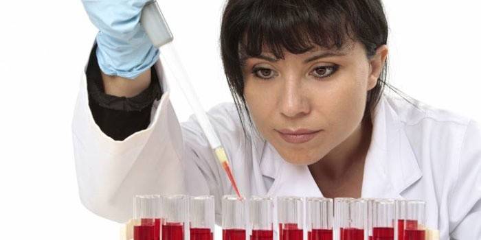 Skúmavky s laboratórnym asistentom a krvné testy