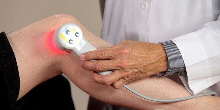 Fisioterapia para la artrosis.