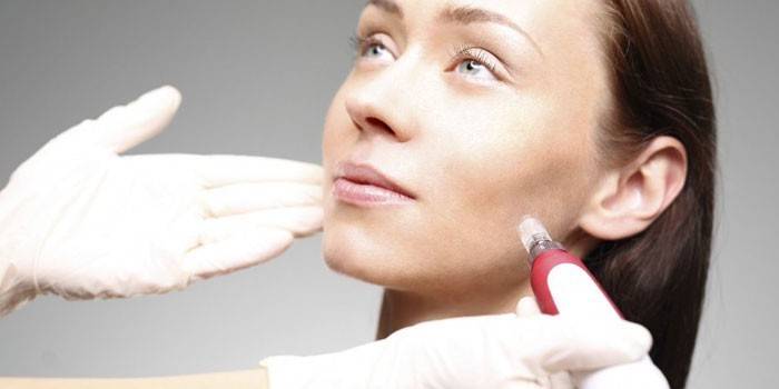 Procedimiento cosmético para la cara