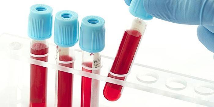 Krvné testy in vitro