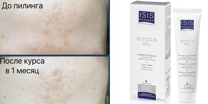 Peeling de Creme Glyko-A