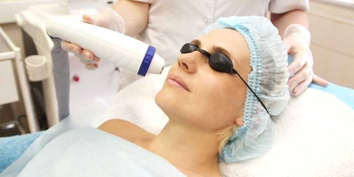 Mulher, sofrendo, phototherapy