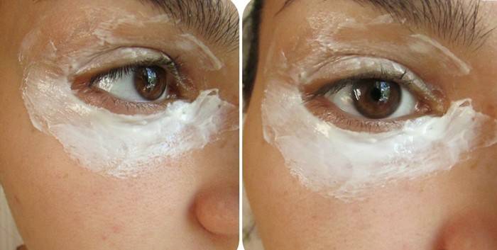 Máscara de iogurte sob os olhos de uma menina