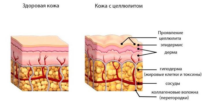 Zdrowa skóra i cellulit