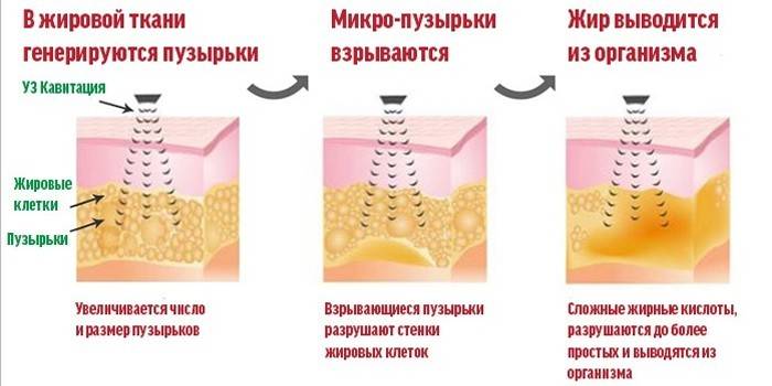 Zasada procedury kawitacji