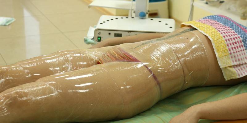 Procedimento de embrulho
