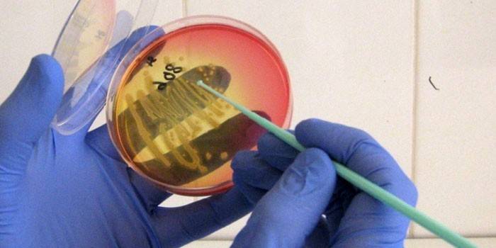 Médico sosteniendo una placa de Petri con material