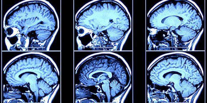 Imágenes de cerebro en capas