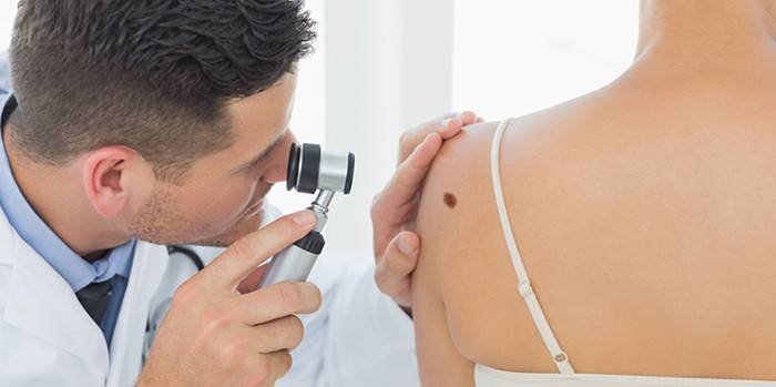 O médico realiza dermatoscopia do nevo