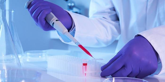 Laboratórny technik vykonáva krvný test