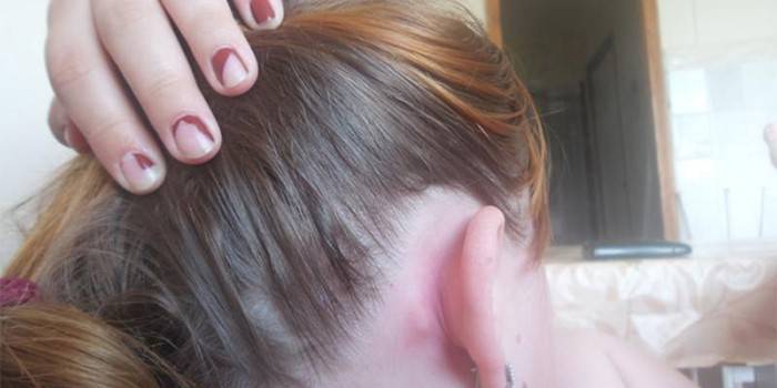 La niña tiene un bulto detrás de la oreja.
