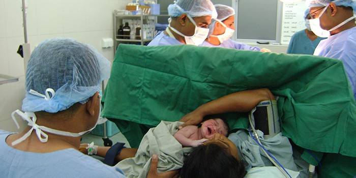 Ameliyathanedeki sağlık ekibi sezaryen yapıyor