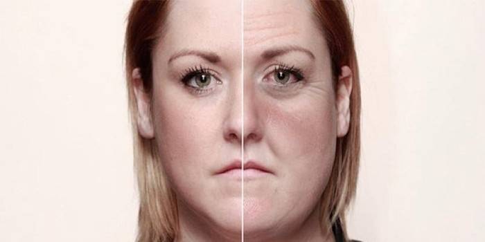 Cambio en la cara de una mujer después del desarrollo de la dependencia del alcohol.