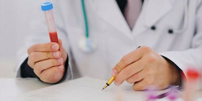 El médico registra los resultados del análisis.