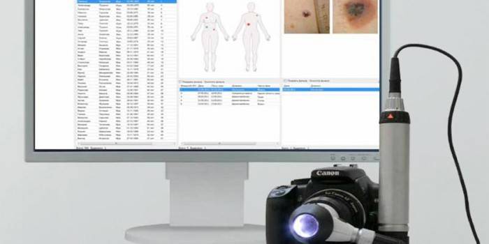 Equipamento de Dermatoscopia
