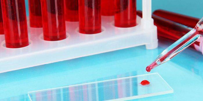 Sangue em tubos de ensaio e vidro de laboratório