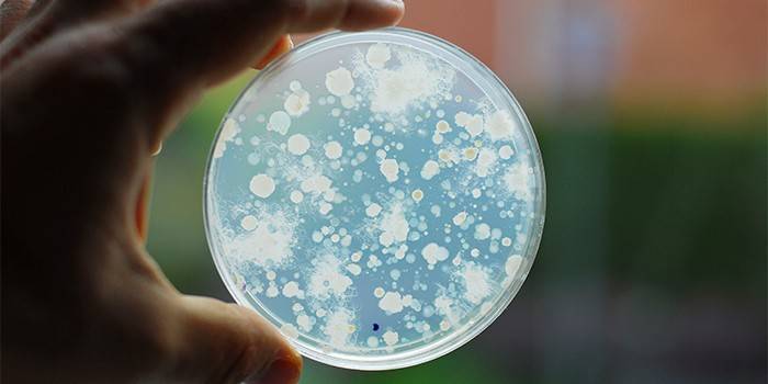 Bacterias en una placa de Petri