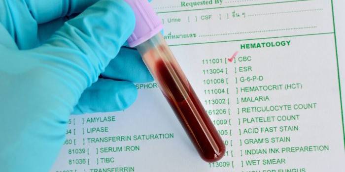 Probówka z krwią w rękach lekarza na tle formularza testowego