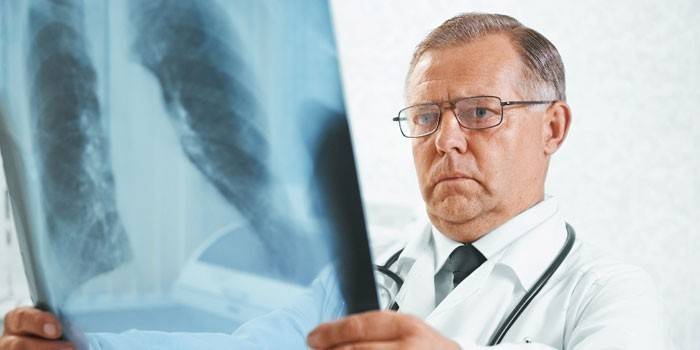 Médico examina um raio-x dos pulmões