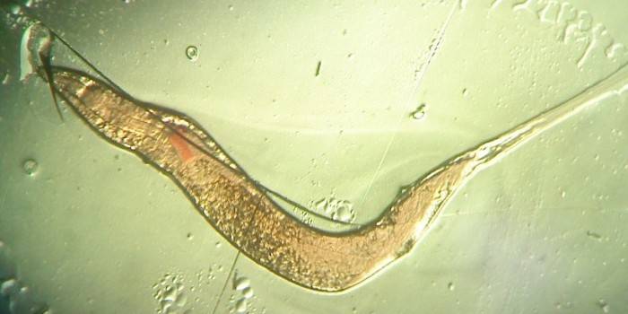 Foto de pinworm sob o microscópio