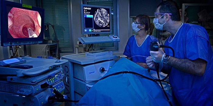 Los médicos realizan endoscopia