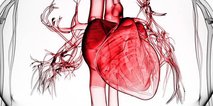 Infarkt