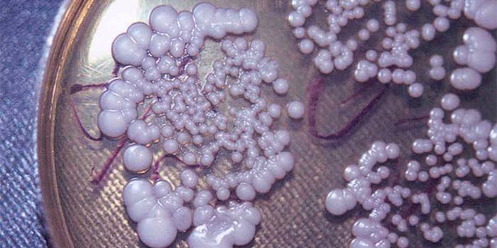 Huby rodu Candida v Petriho miske