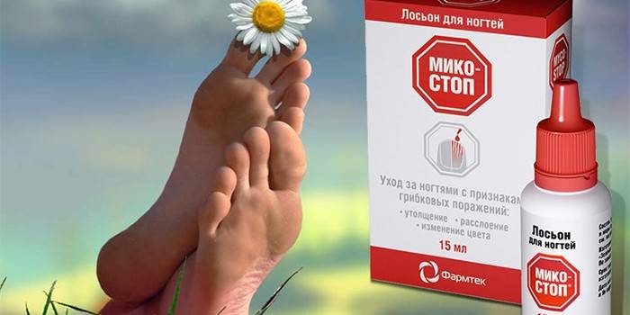 Mycostop mlieko a zdravé nohy