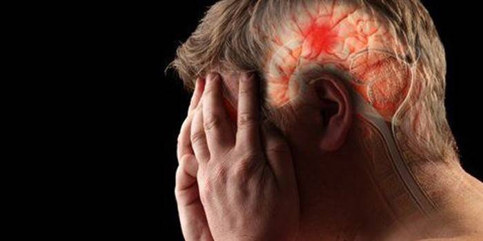 Accidente cerebrovascular en un hombre