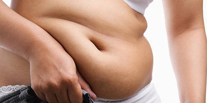 Mujer con sobrepeso