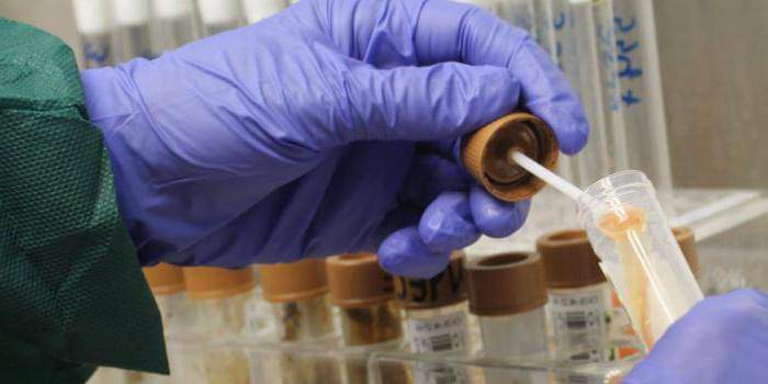 Técnico de laboratório realiza análise fecal