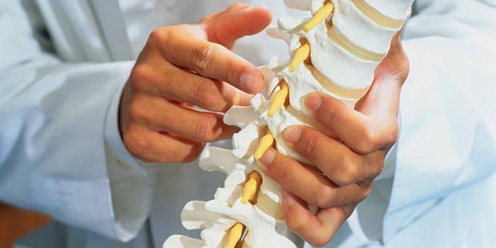 El médico sostiene en su mano un modelo de la columna.