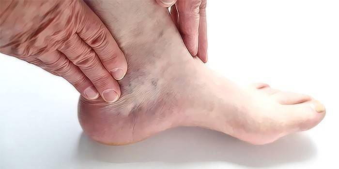 El hombre sostiene sus manos sobre su pierna.