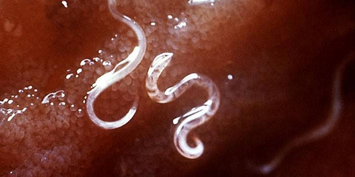 Pinworms em tecidos humanos