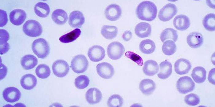 Infecção Fouler Negleria
