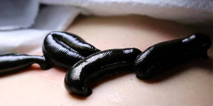 Sanguessugas no corpo humano