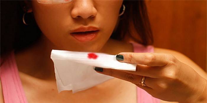 Menina tem um lenço na mão com traços de sangue