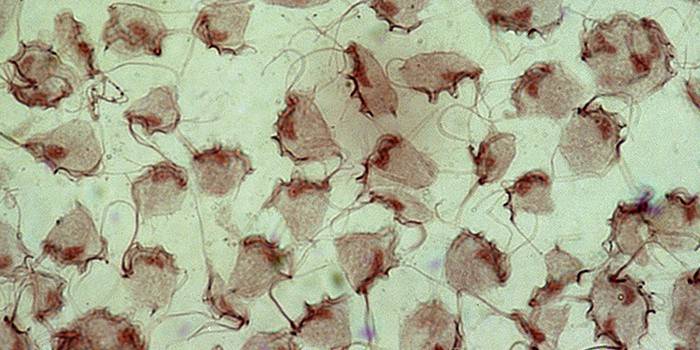 Bacterias Trichomonas bajo el microscopio