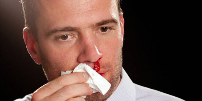 Sangrado nasal en hombres.