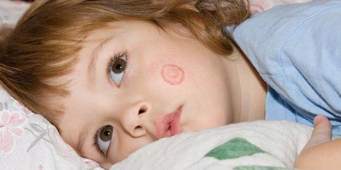 Microscopía en la cara de la niña.