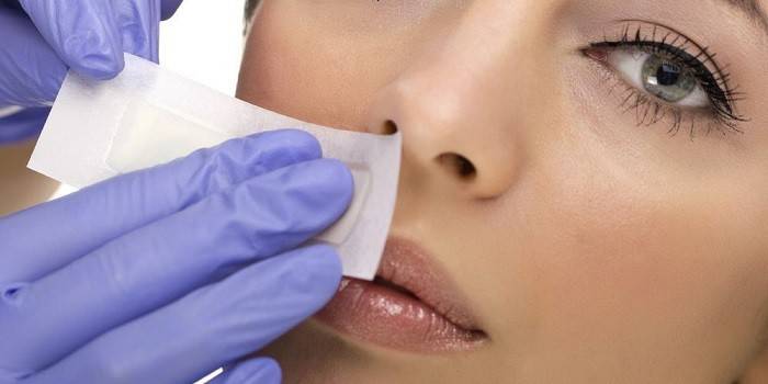 Depilación facial