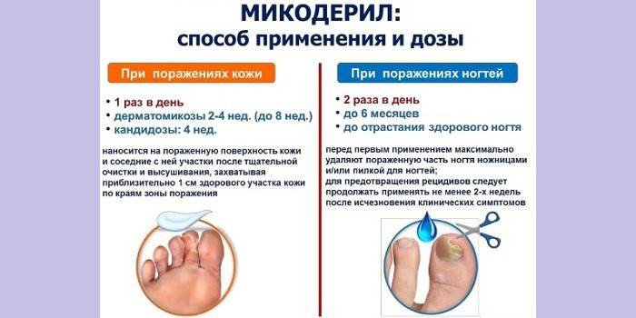 Spôsob použitia lieku Mikoderil