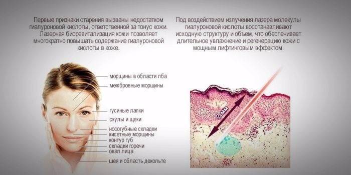 O efeito da biorevitalização do laser na pele