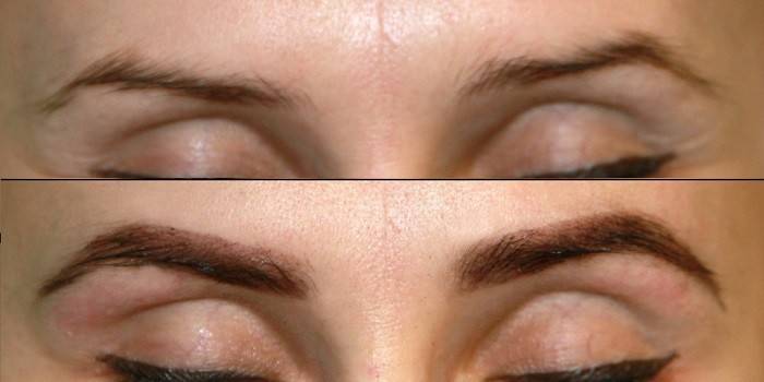 Sobrancelhas de mulher antes e depois da biotaturação com hena